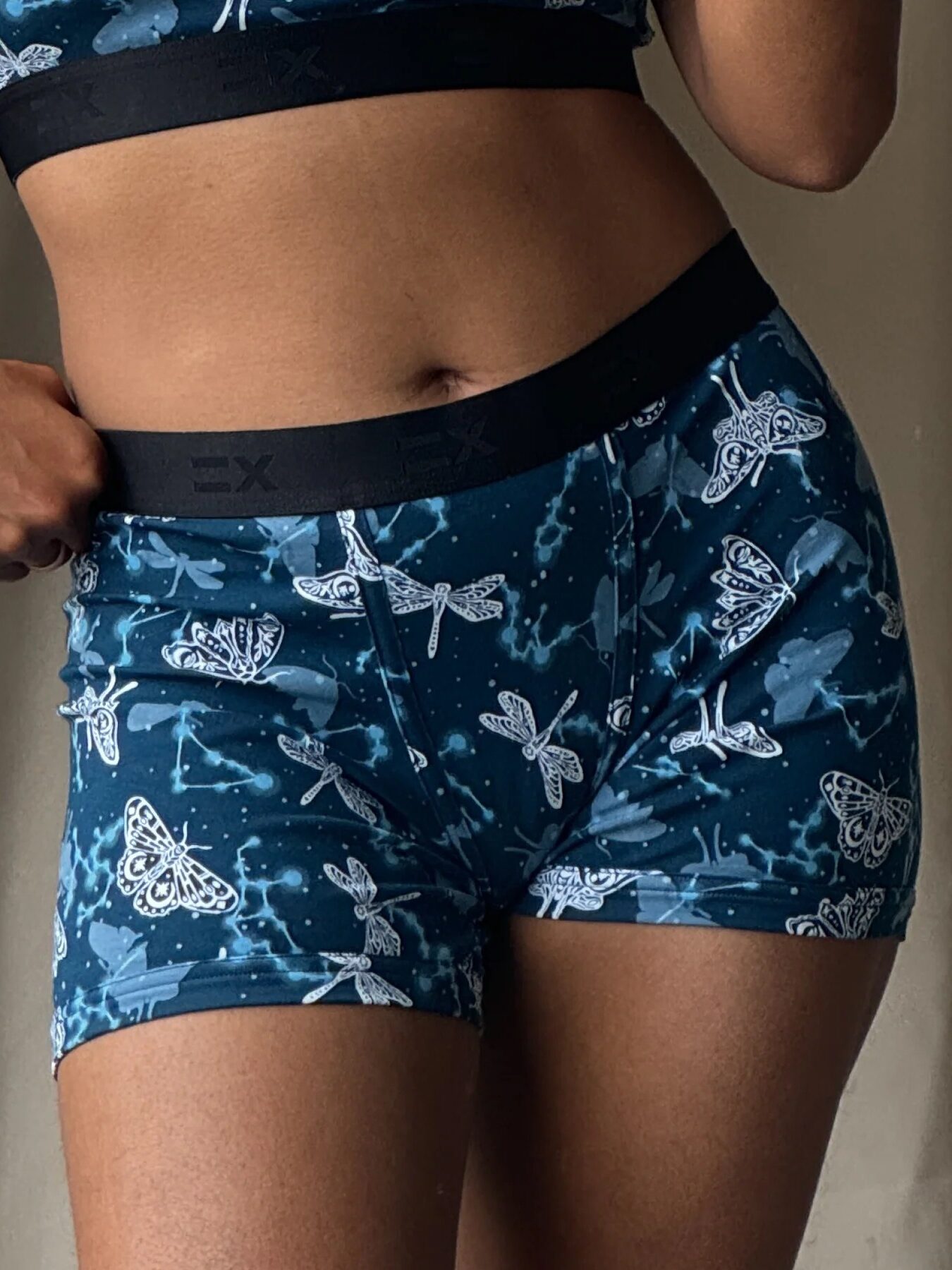 Person in blue butterfly-patterned shorts and matching top, hand on hip.